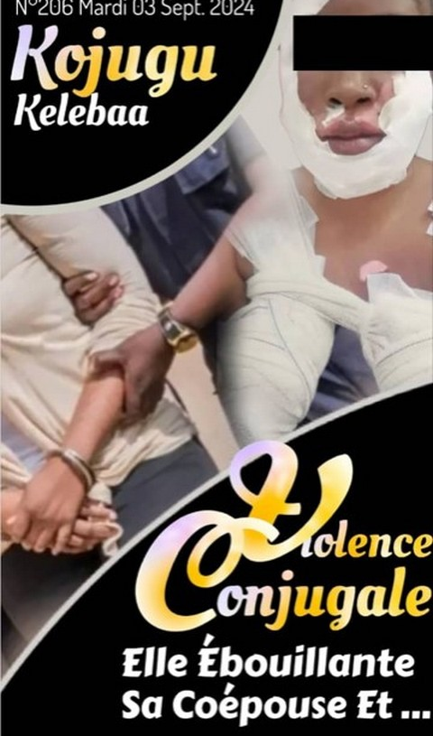 Boulkassoumbougou : violence conjugale… Elle ébouillante sa coépouse et…