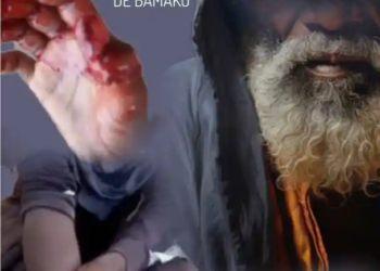 NIAMANA,:A cause d’une pomme, un père mutile sa fillette de 10 ans d’un coup de machette !